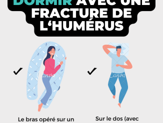 découvrez comment bien dormir avec une attelle pour favoriser une récupération optimale. nos conseils pratiques vous aideront à améliorer votre confort nocturne tout en assurant la protection de votre corps.